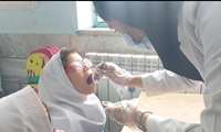 آغاز طرح وارنیش فلورایدتراپی در مدارس خراسان شمالی