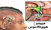 ابتلا به پوکی استخوان با کاهش هورمون های جنسی