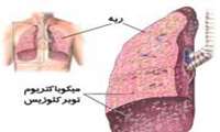 ارائه تمام اقدامات تشخیصی و درمانی سل به صورت رایگان